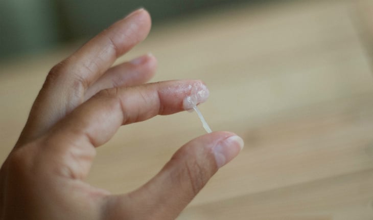 الإفرازات البيضاء الكريمية